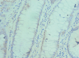 BAF53 / ACTL6A Antibody (aa1-280)