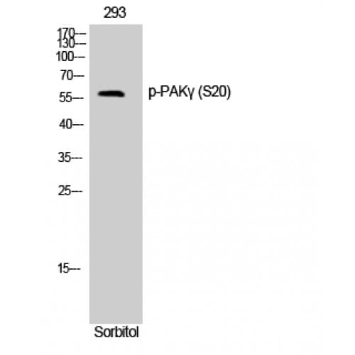 PAK2 Antibody (1-80 aa)