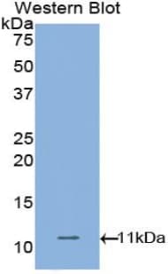 CDH1 / E Cadherin Antibody (aa784-870)