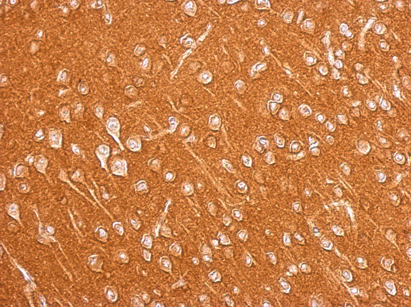 Polyclonal Rabbit anti-Human AMPH / Amphiphysin Antibody (aa1-194, IHC, WB)
