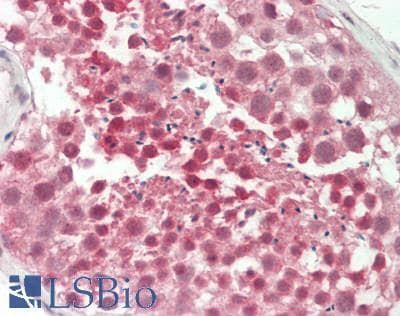 IHC-plus™ Polyclonal Rabbit anti-Human COPS2 / TRIP15 / ALIEN Antibody (aa1-50, IHC, WB)