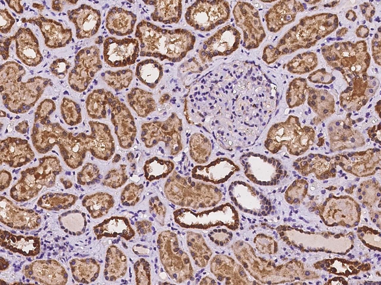 Polyclonal Rabbit anti-Human TMLHE / TMID Antibody (IHC)