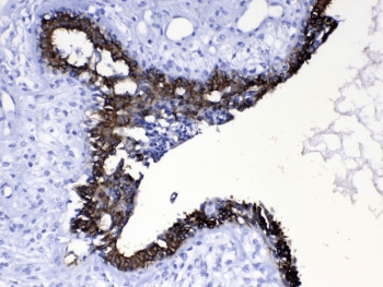 KRT8 / CK8 / Cytokeratin 8 Antibody