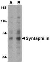 IHC-plus™ SNPH Antibody