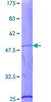 Human TNNI2 Protein (Recombinant GST)