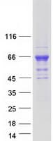 Human CAMKK2 Protein (Recombinant Myc-DDK (Flag))