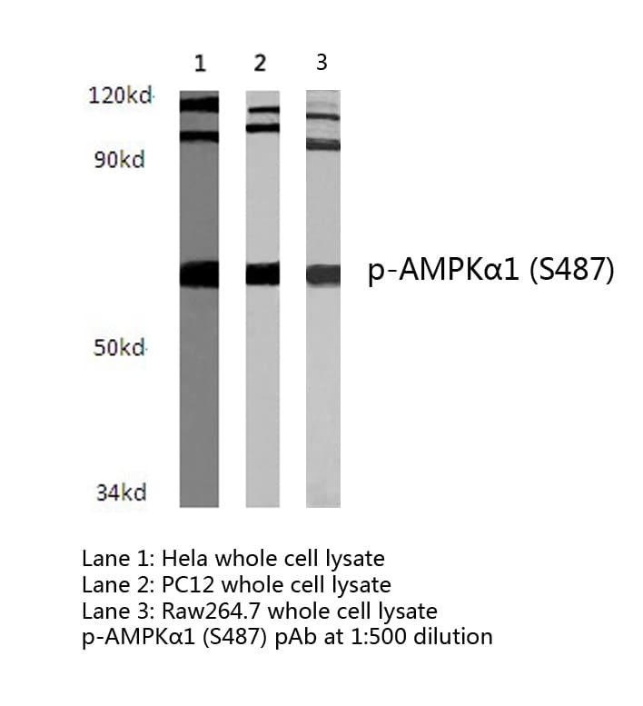 Polyclonal Rabbit anti-Human PRKAA1 / AMPK Alpha 1 Antibody (phospho-Ser486, IHC, WB)