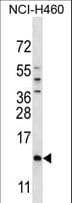 Polyclonal Rabbit anti-Human SMCP Antibody (aa68-97, WB)