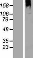 BTBD16 Protein (Over-Expression Lysate Myc-DDK (Flag))