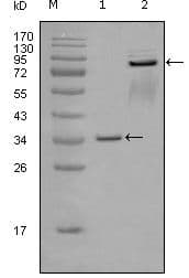 EPHA7 / EPH Receptor A7 Antibody (Amino Acid: 27-210, clone 6C8G7)