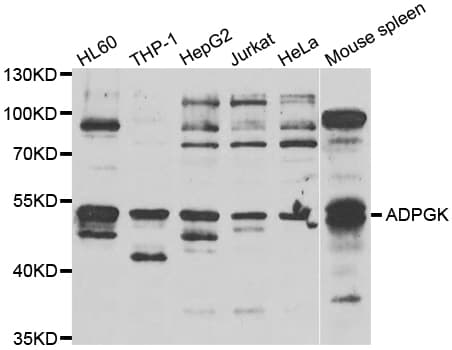 ADPGK Antibody