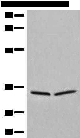 DIMT1L Antibody