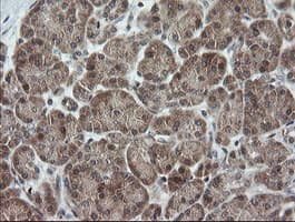 OTUB1 / OTU1 Antibody (clone OTI1E3)