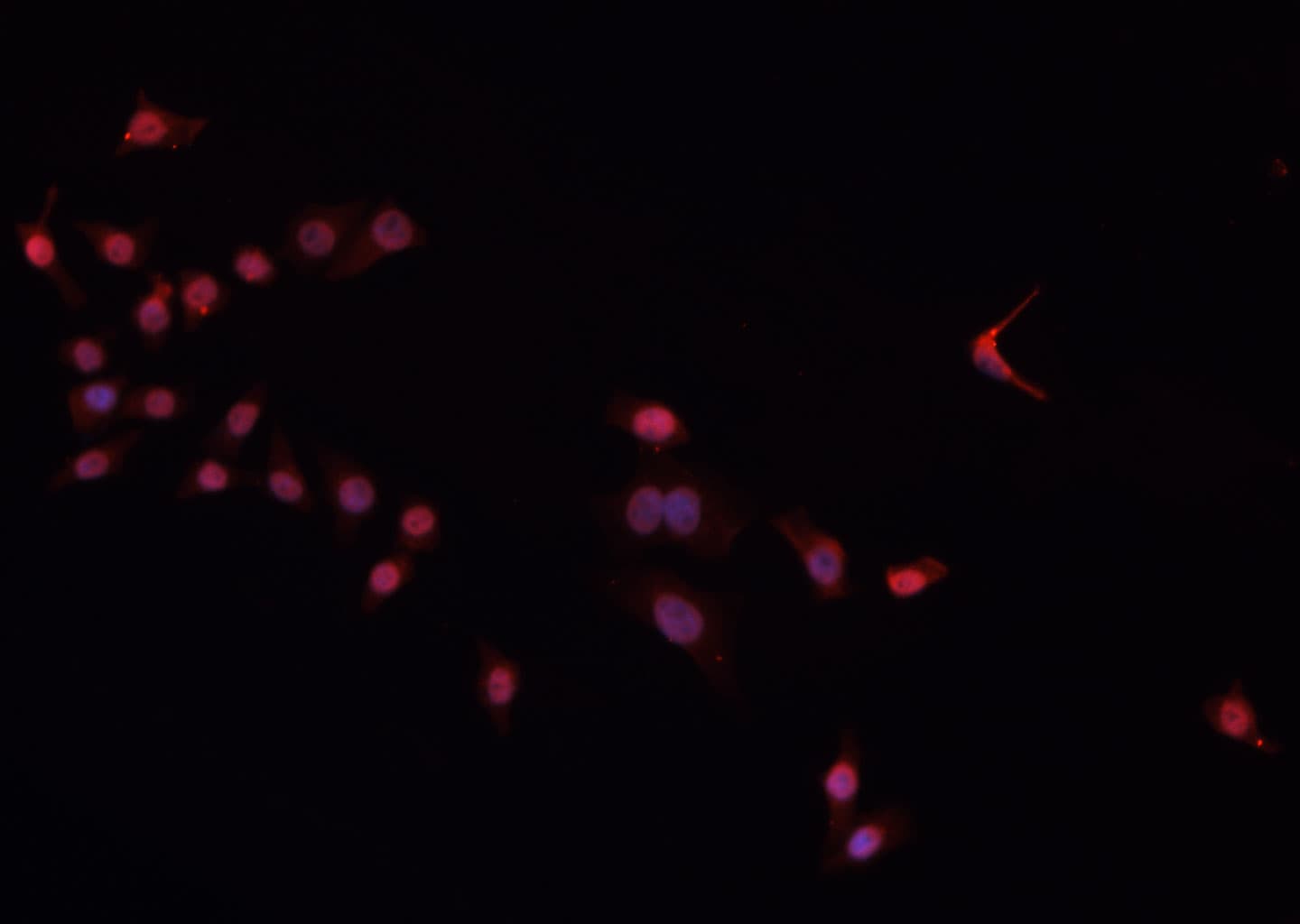 POU2F2 / OCT2 Antibody