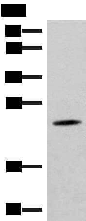 TBPL1 / TRF2 Antibody