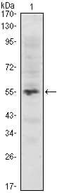 IHC-plus™ MUM1 Antibody (clone 4G10)