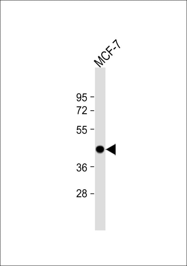 RRS1 Antibody