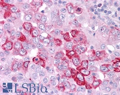PathPlus™ Polyclonal Rabbit anti-Human GPER1 / GPR30 Antibody (C-Terminus, IHC, IF, WB)