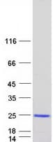 Human VPS25 Protein (Recombinant Myc-DDK (Flag))