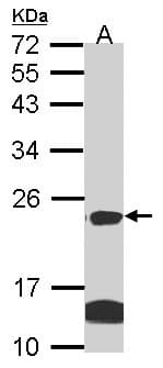 IHC-plus™ Polyclonal Rabbit anti-Human CLDN14 / Claudin 14 Antibody (aa177-239, IHC, WB)