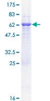 Human CRYZ Protein (Recombinant GST)