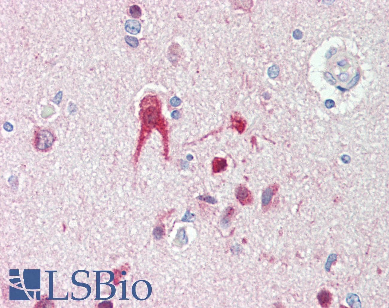 IHC-plus™ TLR2 Antibody (N-Terminus)