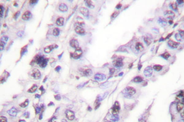 Polyclonal Rabbit anti-Human XRCC5 / Ku80 Antibody (Asp708, IHC, IF, WB)