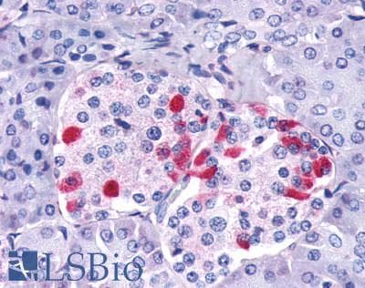 PathPlus™ GIPR / GIP Receptor Antibody (Cytoplasmic Domain)