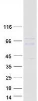 Human RBPJ Protein (Recombinant Myc-DDK (Flag))