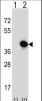 Polyclonal Rabbit anti-Human RFC5 Antibody (aa170-200, WB)