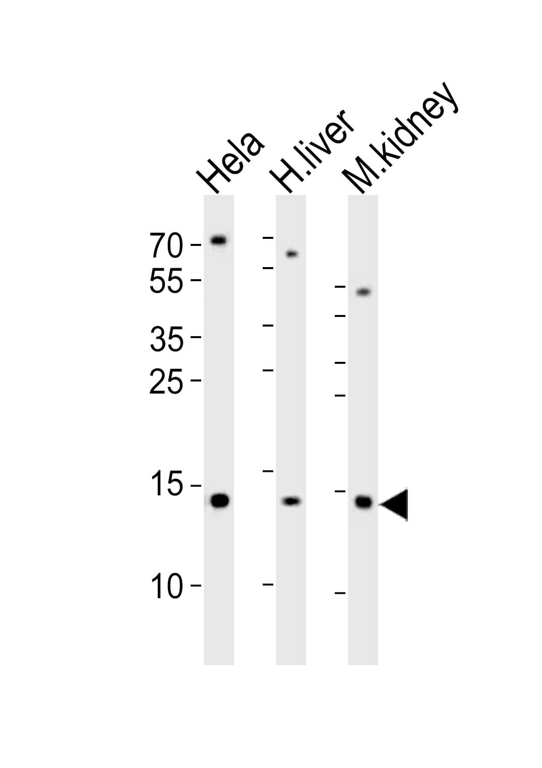 Polyclonal Rabbit anti-Human CDA / Cytidine Deaminase Antibody (aa51-83, WB)