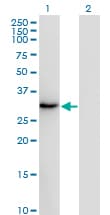 IHC-plus™ SSX2 Antibody (clone 1A4)