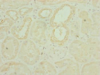 Polyclonal Rabbit anti-Human CHCHD3 Antibody (IHC, WB)