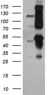 Polyclonal Rabbit anti-Human CUX1 / CASP Antibody (WB)