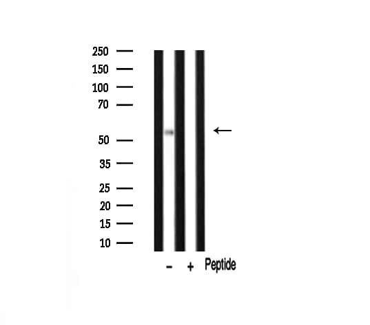 Peripherin Antibody (aa445-470)