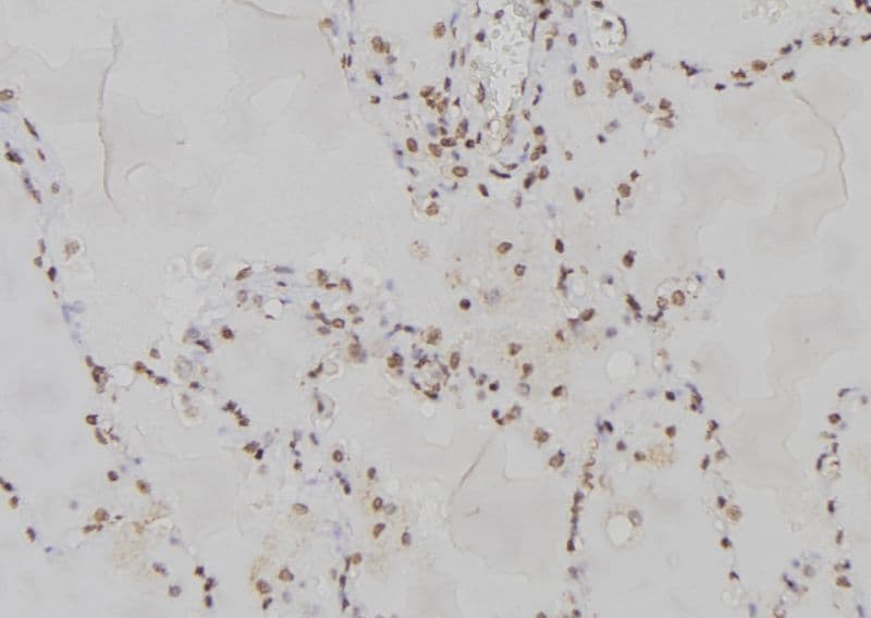 PPP2R2A Antibody