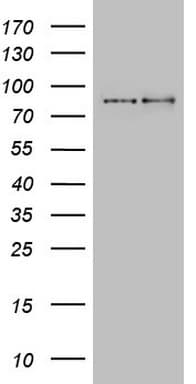 GPR49 / LGR5 Antibody (aa22-543, clone UMAB210, Carrier-free)