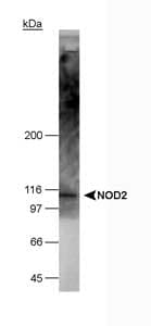 NOD2 / CARD15 Antibody (aa28-301, clone 2D9)