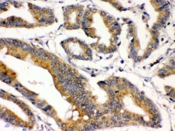 BMP2 Antibody