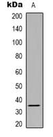 SRSF8 Antibody (Internal)