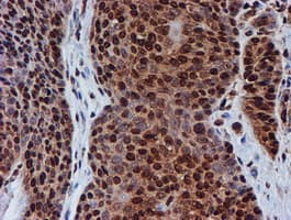 FMR1 / FMRP Antibody (clone OTI3B4)