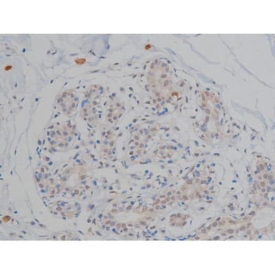 MAPT / Tau Antibody (phospho-Thr231)