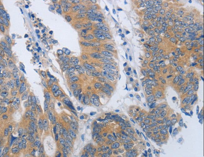 Polyclonal Rabbit anti-Human MME / CD10 Antibody (IHC, WB)