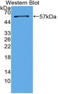 SFTPA1 / Surfactant Protein A Antibody (aa21-248)