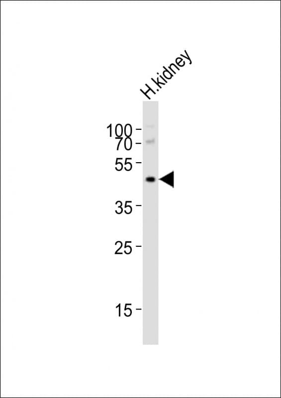 Polyclonal Rabbit anti-Human NPY2R Antibody (aa29-65, WB)