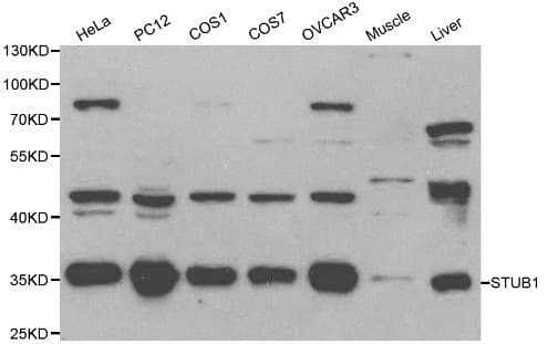 IHC-plus™ STUB1 / CHIP Antibody