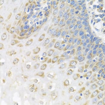 Polyclonal Rabbit anti-Human PABPC4 Antibody (IHC, WB)