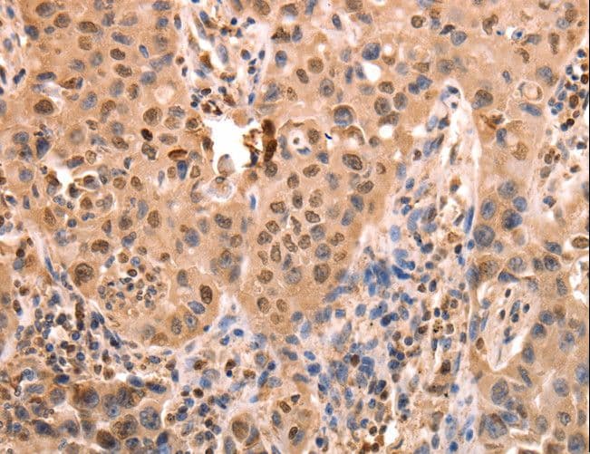 Polyclonal Rabbit anti-Human ACO2 / Aconitase 2 Antibody (IHC, WB)