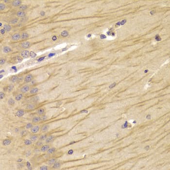 Polyclonal Rabbit anti-Human TCN2 Antibody (IHC, WB)