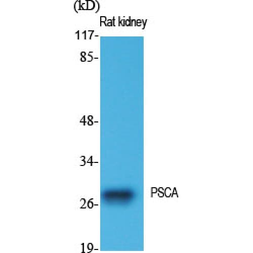 PSCA Antibody (10-90 aa, Internal)